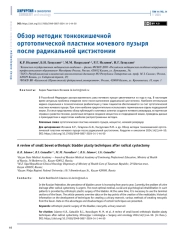 ОБЗОР МЕТОДИК ТОНКОКИШЕЧНОЙ ОРТОТОПИЧЕСКОЙ ПЛАСТИКИ МОЧЕВОГО ПУЗЫРЯ ПОСЛЕ РАДИКАЛЬНОЙ ЦИСТЭКТОМИИ
