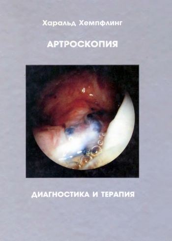 Артроскопия. Диагностика и терапия