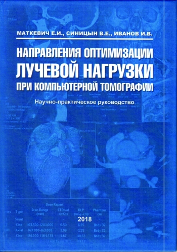 НАПРАВЛЕНИЯ ОПТИМИЗАЦИИ ЛУЧЕВОЙ НАГРУЗКИ ПРИ КОМПЬЮТЕРНОЙ ТОМОГРАФИИ